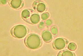 près plusieurs heures de fermentation, les corps lipidiques occupent la quasi-totalité de l’espace intracellulaire illustrant le remarquable potentiel d’accumulation lipidique de Yarrowia lipolytica. Source : SAS PIVERT.