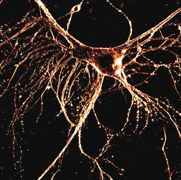 © Collaboration D. Dombeck, W. W. Webb (Cornell) © Collaboration D. Dombeck, W. W. Webb (Cornell)